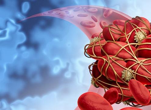 Анализ крови на мутации генов гемостаза