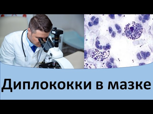 Гонококки в мазке у женщин что это