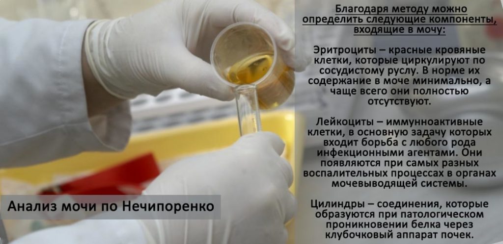 Как собирать анализ мочи по сулковичу