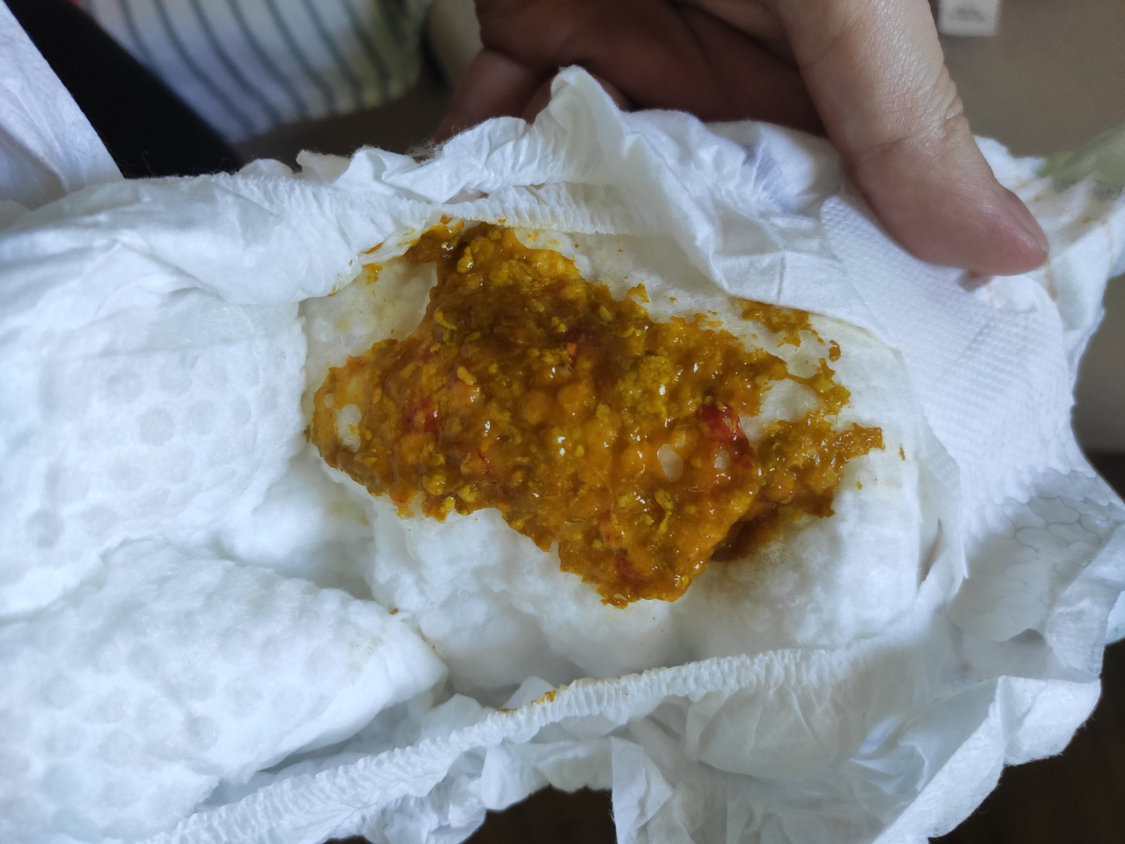 Кровь в стуле у грудничка