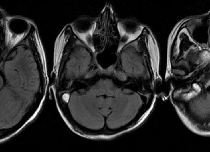Лор органов мрт