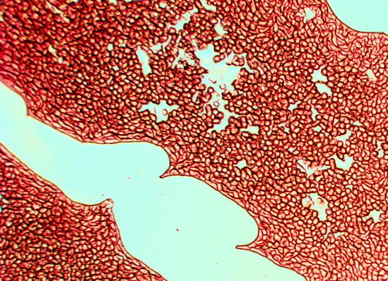Как выглядит кровь