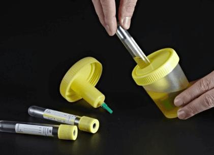 Как правильно сдавать мочу суточную Как правильно сдавать мочу суточную