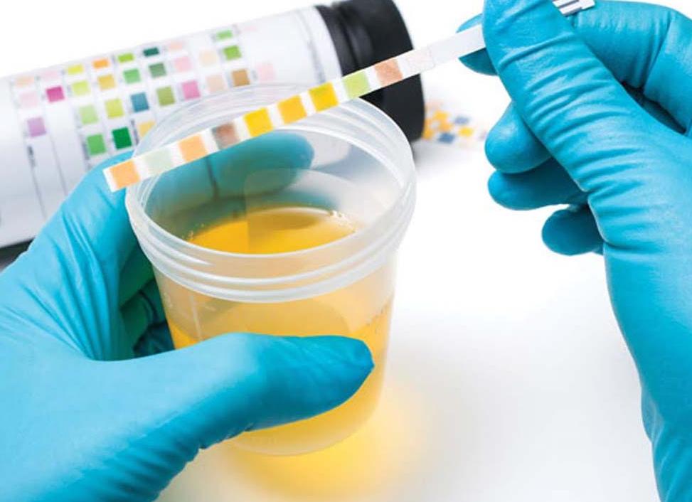 Как правильно сдавать анализ по нечипоренко