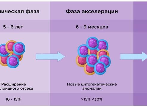 Хронический лимфолейкоз стадия в
