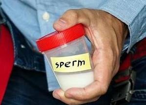 Что показывает анализ спермограммы