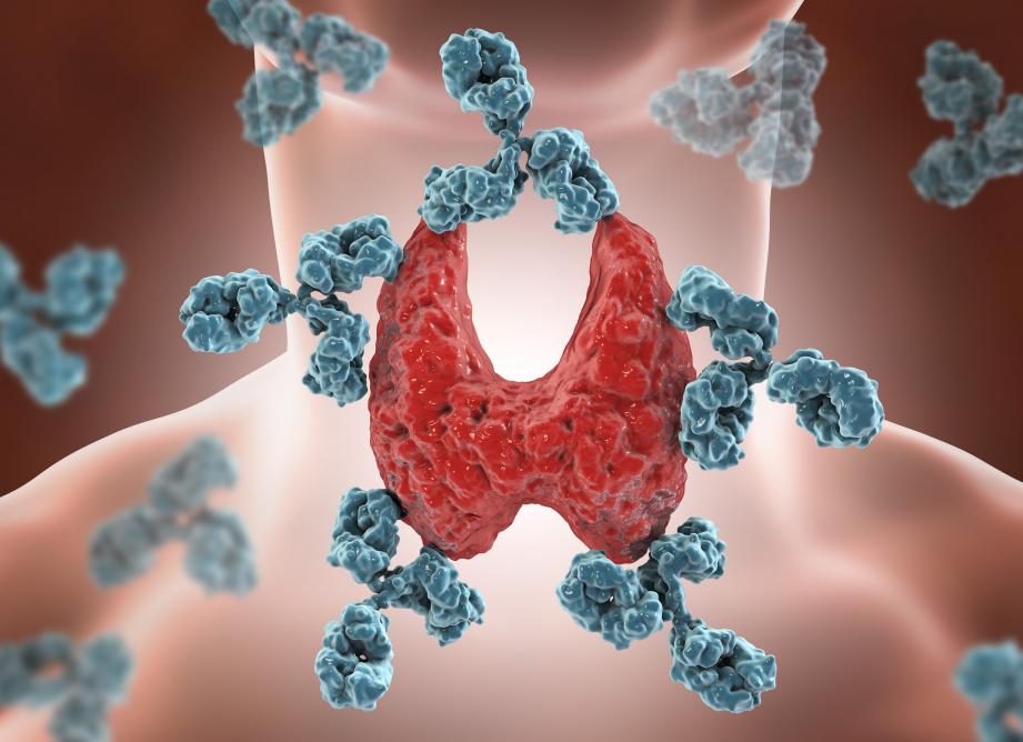 Ат тпо анализ Ат тпо анализ