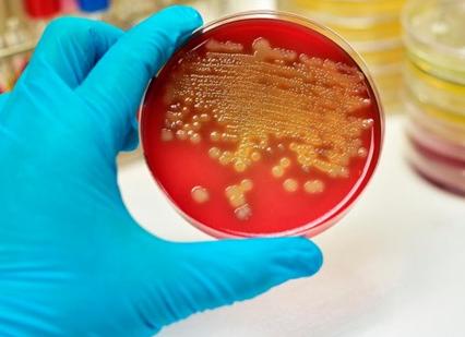 Анализ кала скрытая кровь что это значит