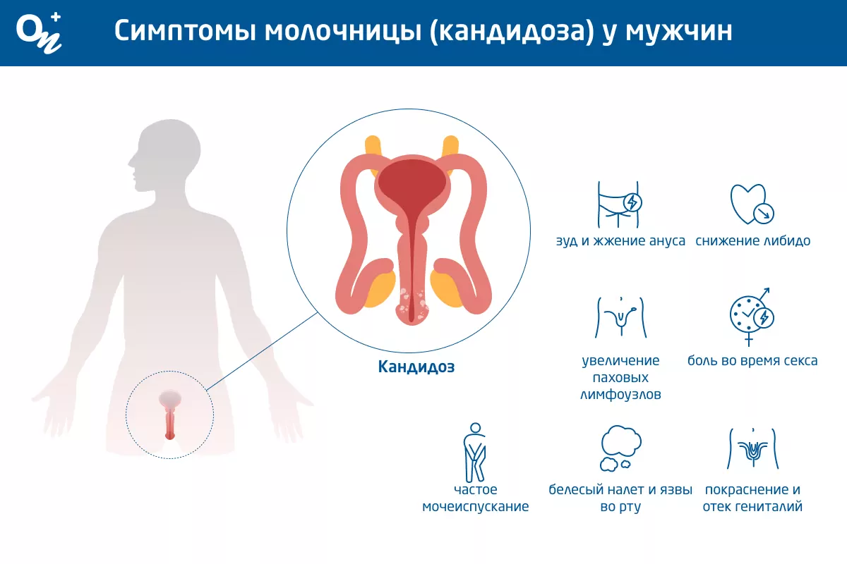 Молочница у мужчин откуда берется