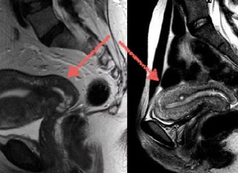 Мрт таза что показывает