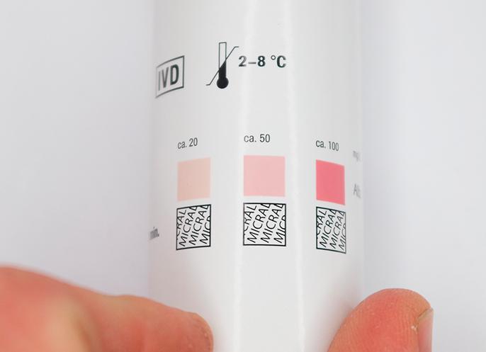 Микроальбуминурия что такое