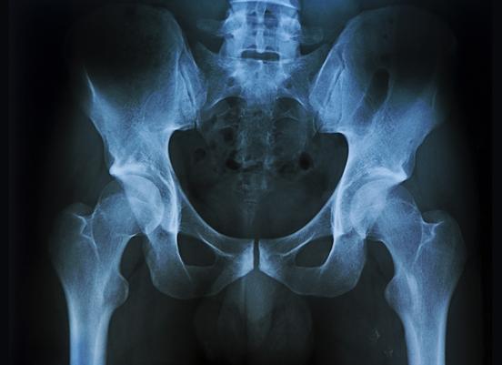 Как подготовиться к рентгену пояснично крестцового отдела позвоночника