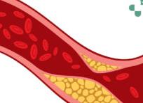 Холестерин от чего бывает