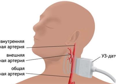 Что такое уздг бца
