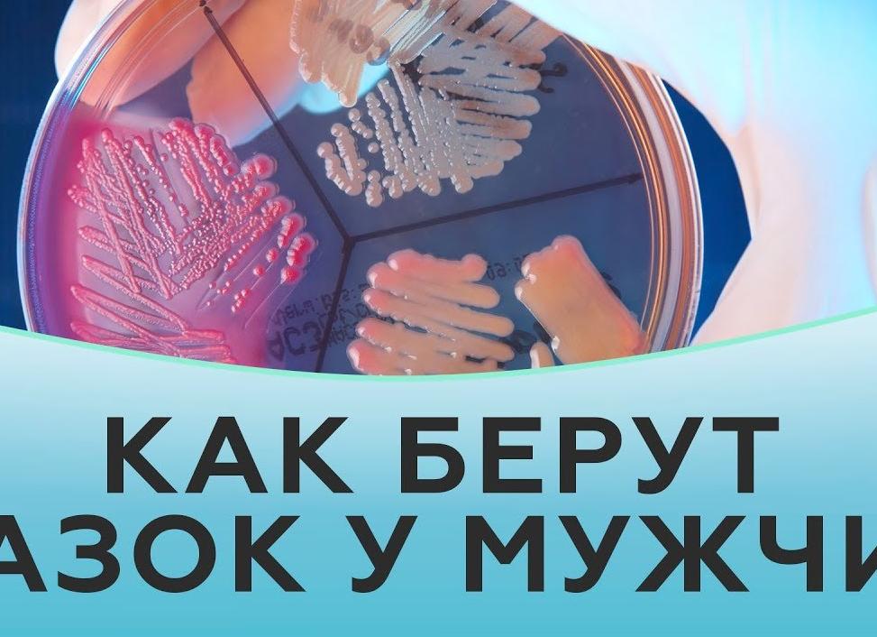 Больно ли брать мазок у мужчин