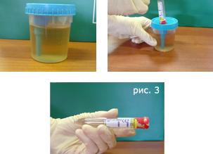 Анализ мочи сколько можно хранить Анализ мочи сколько можно хранить