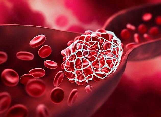 Ачтв ниже нормы Ачтв ниже нормы