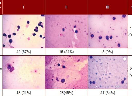 Лецитиновые зерна незначительное количество