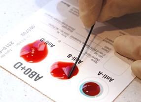 Кровь на группу крови натощак или нет