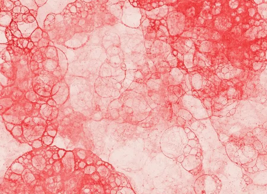 Как в норму привести лейкоциты