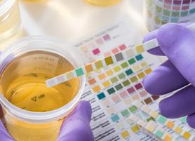 Как собрать мочу на сахар