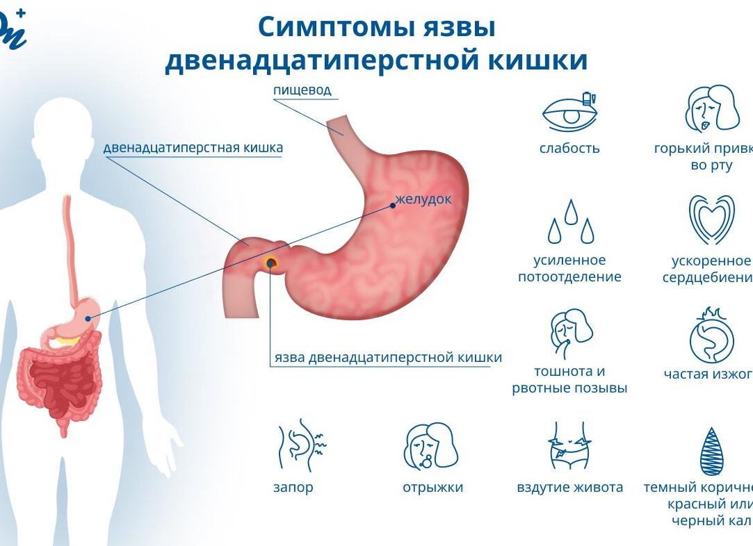 Как проверить двенадцатиперстную кишку