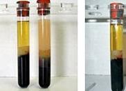 Иктеричность крови при сдаче анализов
