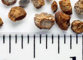 Фосфатурия что это такое