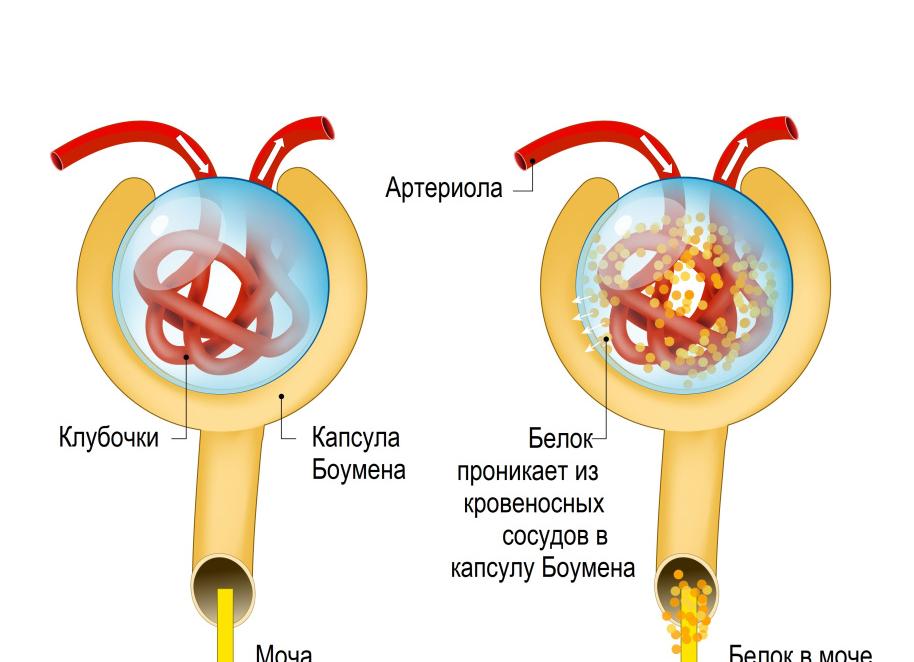 Должен ли быть в моче белок