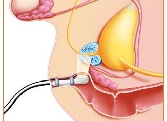 Что такое гистологическое исследование