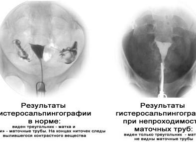 Что делать если трубы не проходимы Что делать если трубы не проходимы