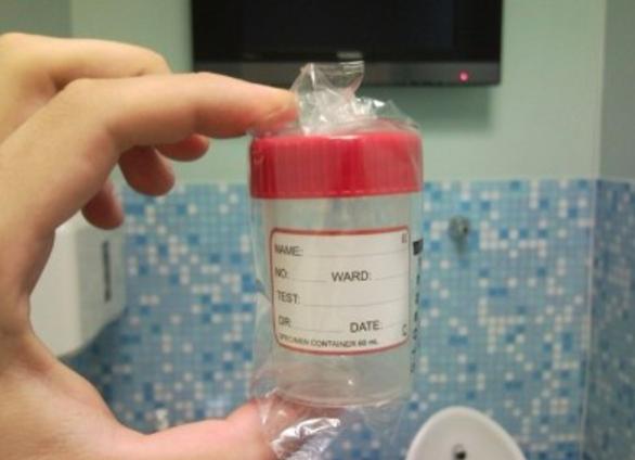 Биохимия мочи как собирать