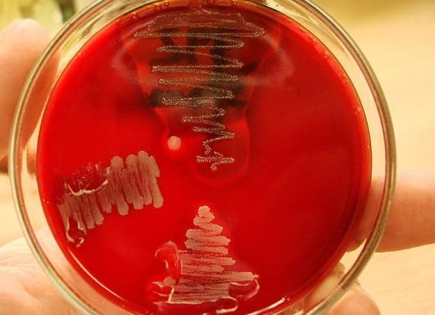 Анализ спермы на бактерии
