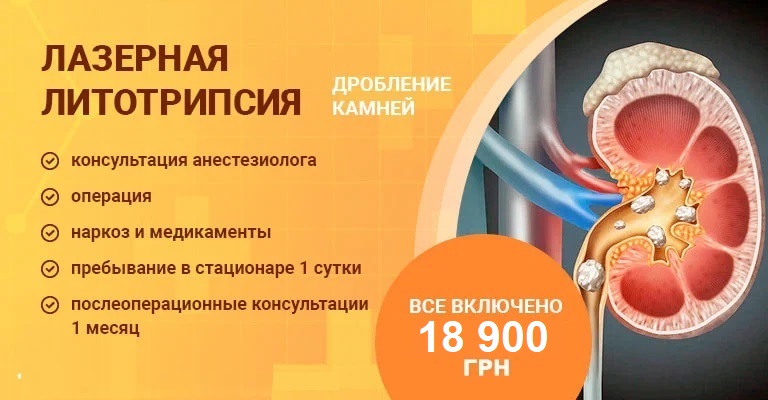 Как определить камень в почке