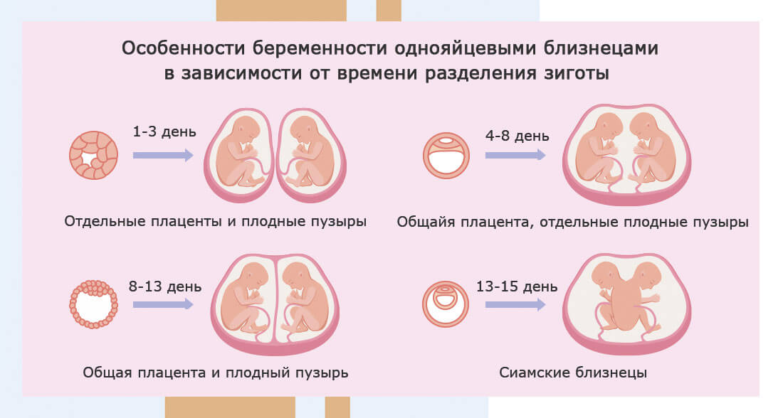 Как узнать на раннем сроке что двойня