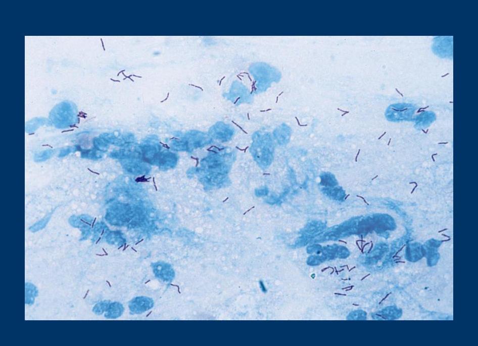 Кум в мокроте это Кум в мокроте это