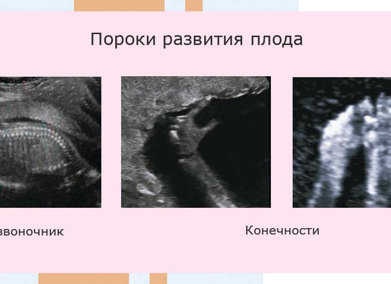 Как узи влияет на плод Как узи влияет на плод