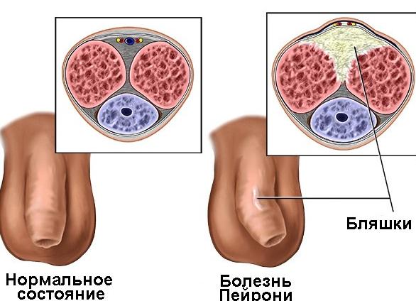 Фото половые болезни