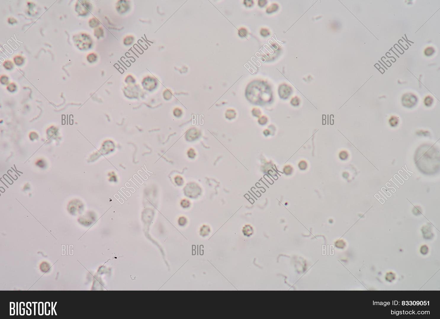 Эритроциты в сперме