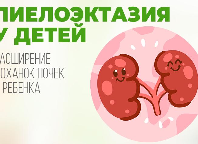 Двусторонняя пиелоэктазия почек у ребенка