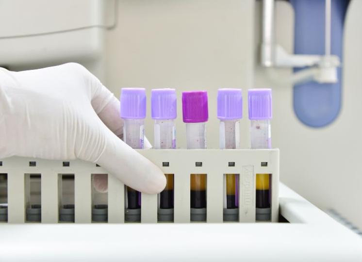 Что в себя включает общий анализ крови