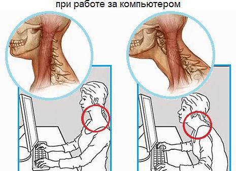 Болит левая сторона шеи и плечо