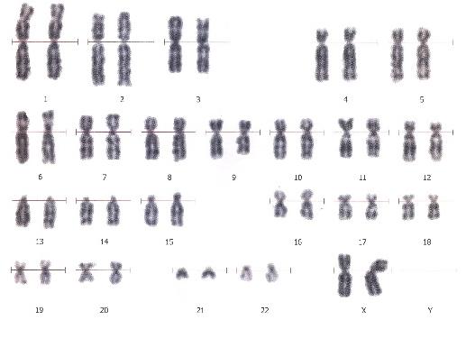 Анализ на кариотип супругов