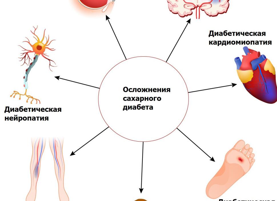 Анализ крови на глюкозу что это такое