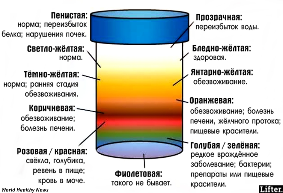 Моча оранжевого цвета