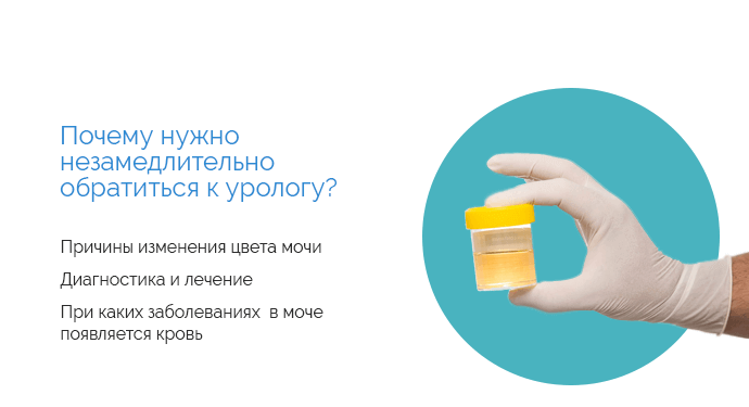 Моча у ребенка темного цвета почему