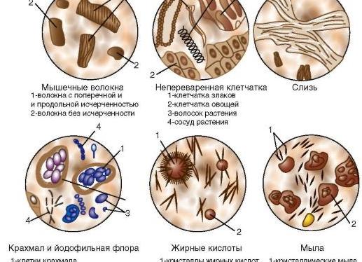 Мышечные волокна с исчерченностью