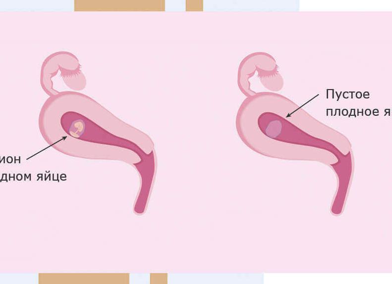 Может ли расти плодное яйцо без эмбриона