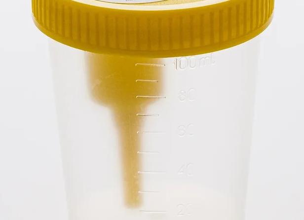 Контейнеры для анализов мочи