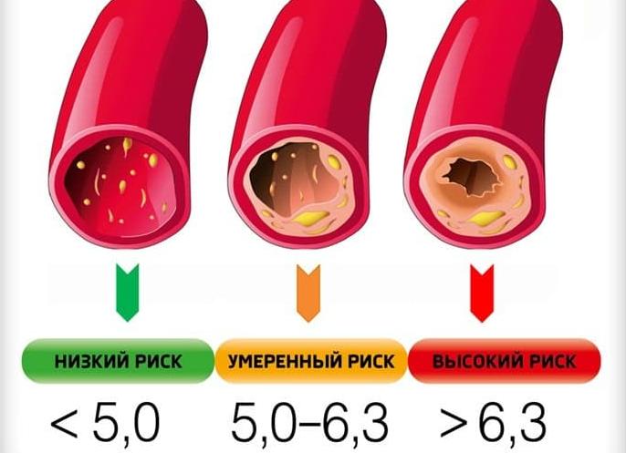 Когда повышен холестерин что делать Когда повышен холестерин что делать